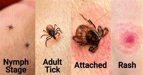 Be Ticked Off Lyme Disease Is Preventable Kuus Inc