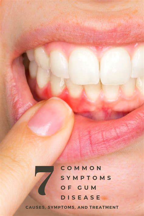 What Does Mouth Cancer Look Like On Gums What Does