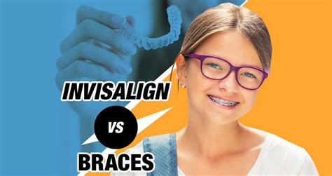 Invisalign Vs Braces Which Should I Choose For My Child