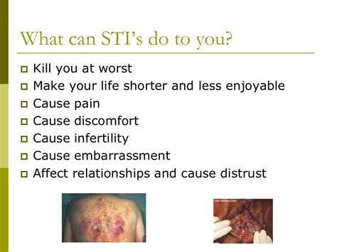 Stis Updated What You Need To Know