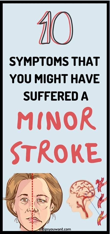 10 Symptoms That You Might Have Suffered A Minor Stroke Stroke Symptoms How To Know Symptoms