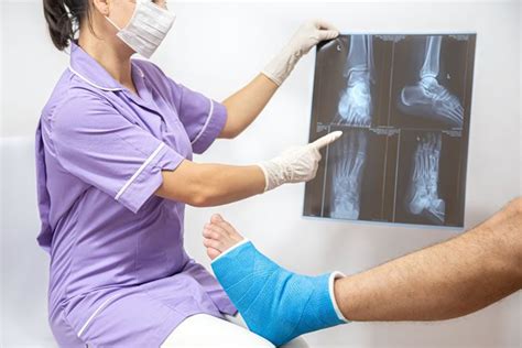 Treat Ankle Fractures Central Florida Bone And Joint Institute