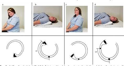 Figure 2 From Optimizing Testing For Bppv The Loaded Dix Hallpike