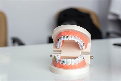 The Benefits And Drawbacks Of Braces Dental Haven