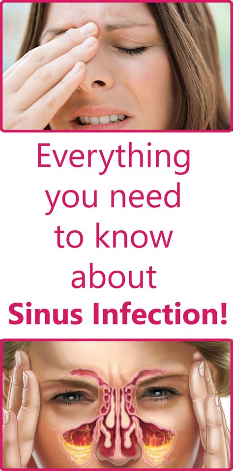 Everything You Need To Know About Sinus Infection Asthma Treatment