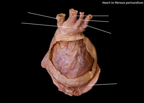 Fibrous Pericardium Diaphragm