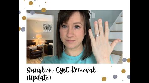 Ganglion Cyst Removal Recovery Update Youtube