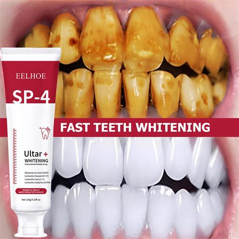 Probiotic Caries Toothpaste Sp 4 Whitening Tooth Decay Repair Paste