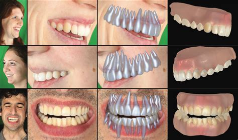 Researchers Can Now Digitize Teeth From A Video Of Someone Smiling