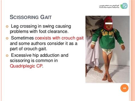 Gait Pattern Classification In Children With Cp