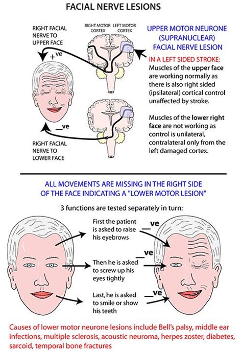 Instant Anatomy Head And Neck Areasorgans Face Facial Nerve