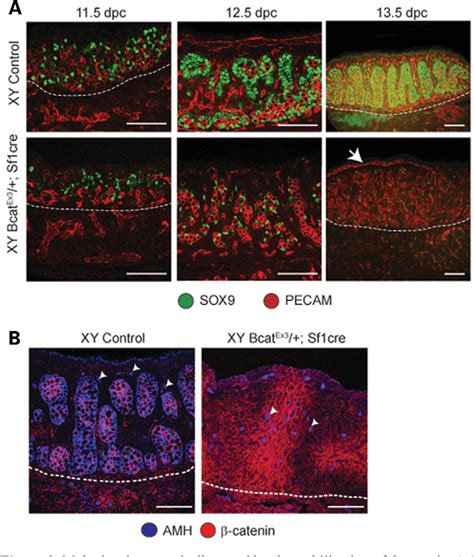 Figure From Stabilization Of Beta Catenin In Xy Gonads Causes Male To Female Sex Reversal