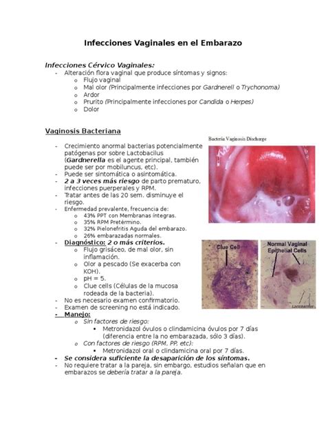Resumen Infecciones Vaginales E Itu Con Imagenes Pdf Rtt