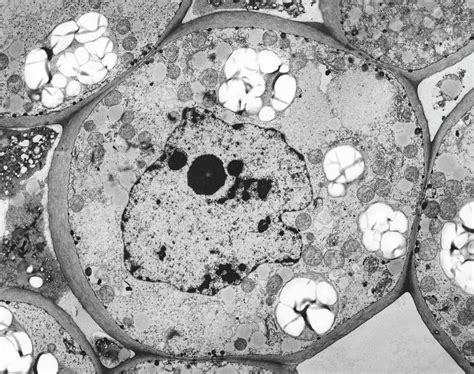 Check spelling or type a new query. Plant Parenchyma Cell Nucleus Photograph by Dennis Kunkel ...