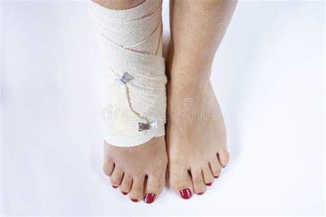 Twisted Bandaged Ankle With Bruise On White Background Athlete Runner