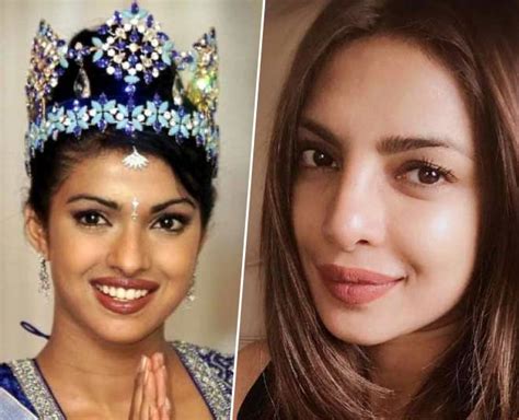 Before And After Pictures Of Bollywood Actresses Who Opted For Plastic
