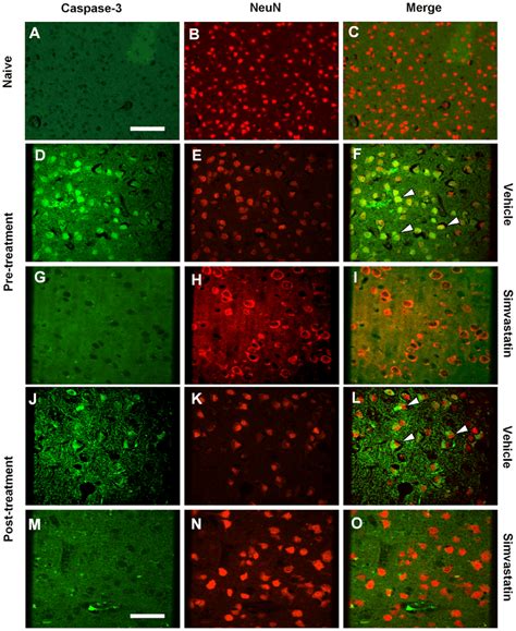 Simvastatin Reduces Caspase 3neun Positive Cells After Sah