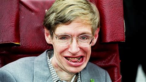 Stephen Hawkings Teeth Stuck Out Because Of Als