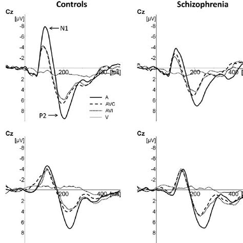 Event Related Potentials Erps Time Locked To Auditory Onset At