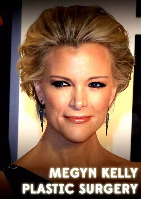 Megyn Kelly Nose Job Before And After
