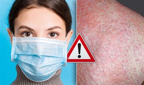 The Deadly Covid Sign On Your Skin That May Appear Without Any Other