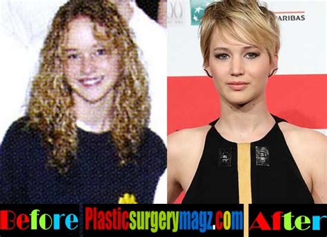 Jennifer Lawrence Plastic Surgery Before And After Plastic Surgery Magazine