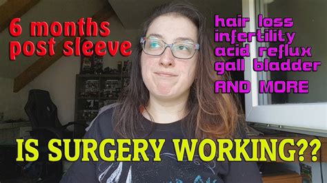 Officially Half Way Last 6 Months Post Op Vsg Youtube