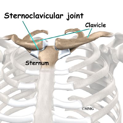 32 867 просмотров 32 тыс. Sternoclavicular Joint Problems | eOrthopod.com