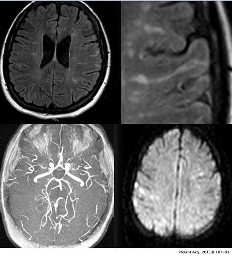 Simple Science: How to Make a Volcano with Kids