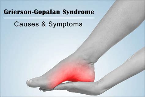 What Is Grierson Gopalan Syndrome How Can It Be Managed In Ayurveda
