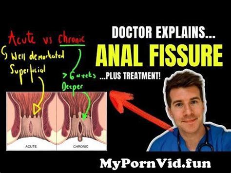 Doctor Explains ANAL FISSURE Including Causes Classification And