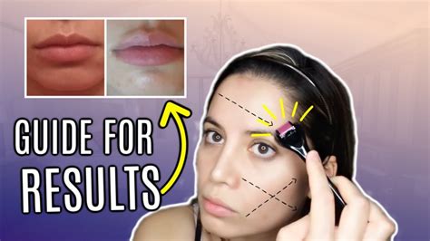 how to derma roll your face dermarolling tutorial youtube