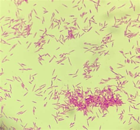 Fusobacterium Gram Stain Morphology Sexiz Pix