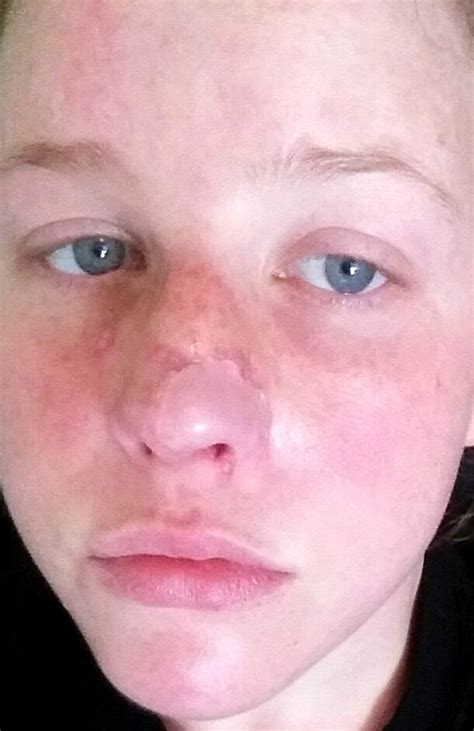 Check spelling or type a new query. Marisha Dotson Shares Photos After Pimple Turns Out to Be ...