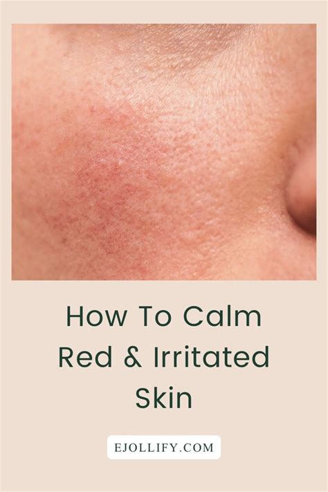 How To Calm Irritated Skin On Your Face Artofit