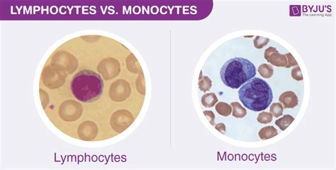 Difference Between Monocytes And Lymphocytes Under Microscope