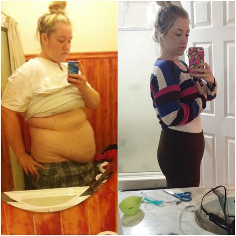Imgur The Most Awesome Images On The Internet Tummy Tuck Before