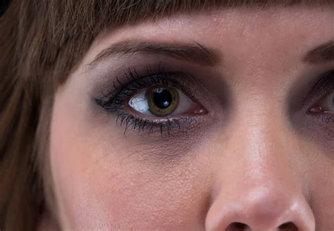 Glasige Augen Ursachen Und Vorbeugung Área Oftalmológica