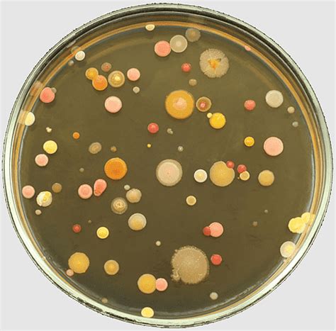 Bacterial Growth On Agar Plates