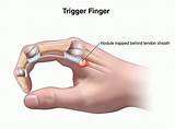 What Doctor To See For Thumb Pain Pictures