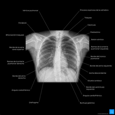 Anatomía Radiológica Rayos X Tac Rm Kenhub
