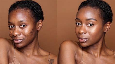 How To Hide Dark Spots On Your Face Without Makeup