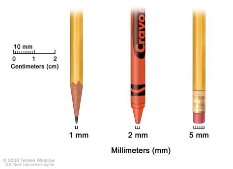 Figure Millimeters Mm A Sharp Pencil Pdq Cancer Information