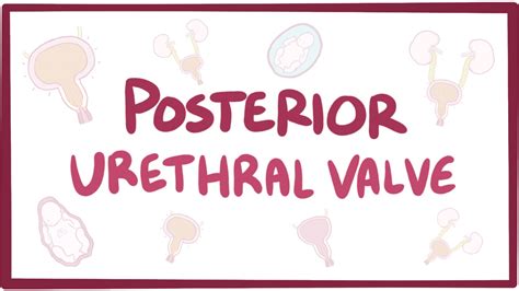 Posterior Urethral Valves Video Anatomy And Definition Osmosis
