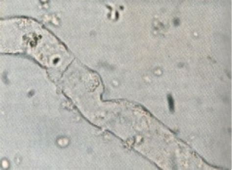 Raros Filamentos De Muco