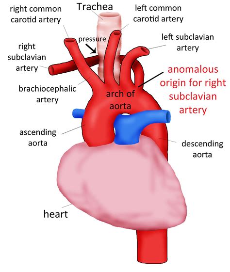What I Know But Without The Official Word Subclavian Artery