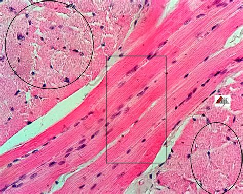 Histology Atlas Online® Tongue Skeletal Striated Muscle Tissue