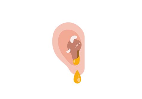 Ear Infection Symptoms Of Ear Infections And Treatment Buoy Health