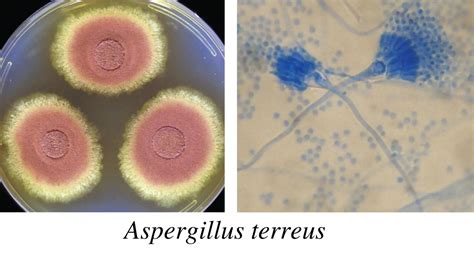 Aspergillus Morphology Clinical Features And Lab Diagnosis • Microbe