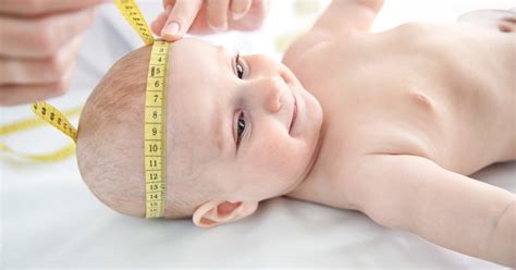 Babys Head Shape 8 Reasons For Uneven Skull When To Worry